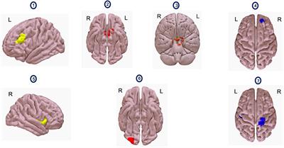 Intermittent theta burst stimulation and functional connectivity in people living with HIV/AIDS who smoke tobacco cigarettes: a preliminary pilot study